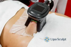 Cryolipolysis Helping You Getting that Perfect Summer Body 3 Cryolipolysis Coombe can give you the best summer body - contact us today!