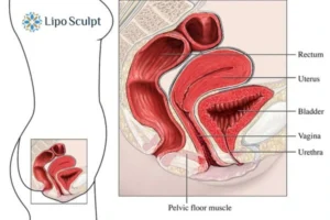 Treatment For A Leaky Bladder 2 How EM Chair treatment Coombe can help Leaky bladder issues. Read more now!