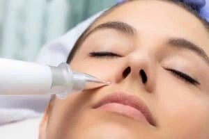 Best Actinic Keratoses Removal 3 Actinic keratoses Coombe solutions - book in today!